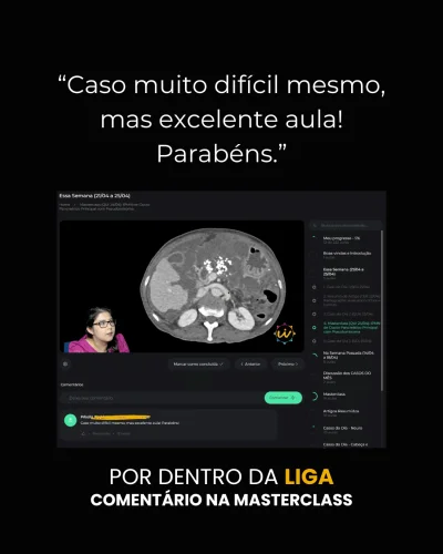 depoimento-LIGA-aula-Nat-rgvvlkbv1uh6ugfgnr0i2nlyyc6v1g28m6a989xcp4