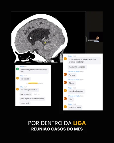 depoimento-LIGA-casos-do-mes-01-rgvviwgboqtxy8aq7lkk0bsyd1bf8bhm8zqqa1vibs